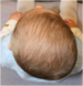 Haltungsasymmetrien beim Säugling und Kleinkind